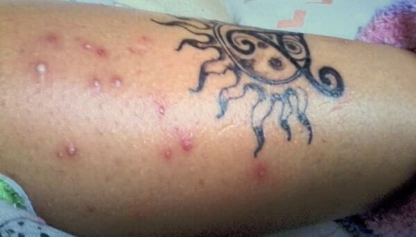 White Bumps & Spots On New and Old Tattoos - AuthorityTattoo