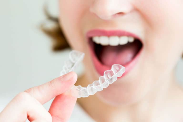 Invisalign Braces are Effective and Safe