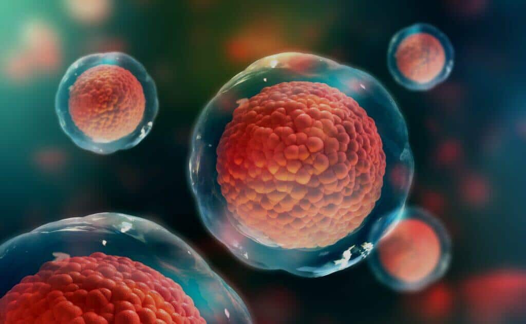 Stem Cell Treatment 