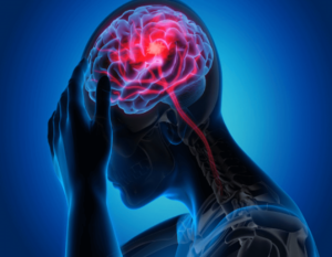 Understanding the Basics of Seizures