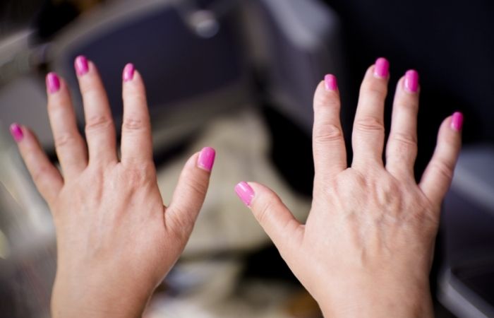 Lupus symptoms Lupus Symptoms